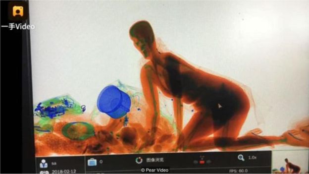 2018’e damga vuran 12 fotoğraf ve çağrıştırdıkları sanat eserleri 5 rontgen