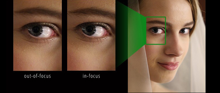 Post Focus Nedir? 5 PF 3