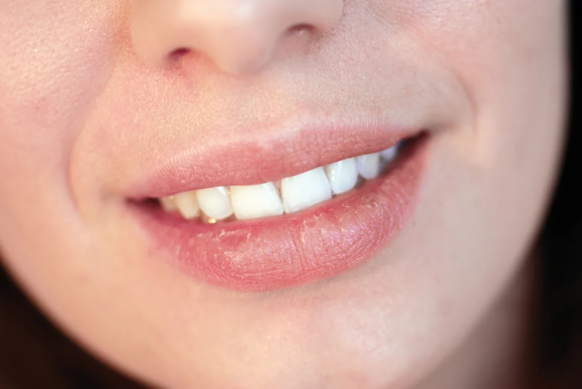 Fotoğraflar İçin Gülümseme: Mükemmel Portreler İçin 8 İpucu 9 dry lips