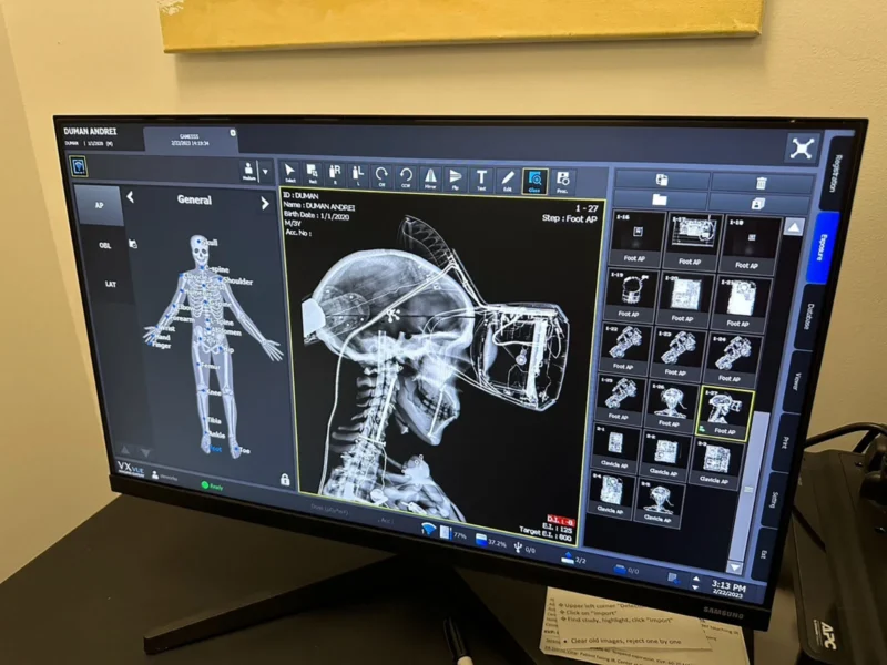 Andrei Duman: X-Ray 9 andrei duman xray bts 2