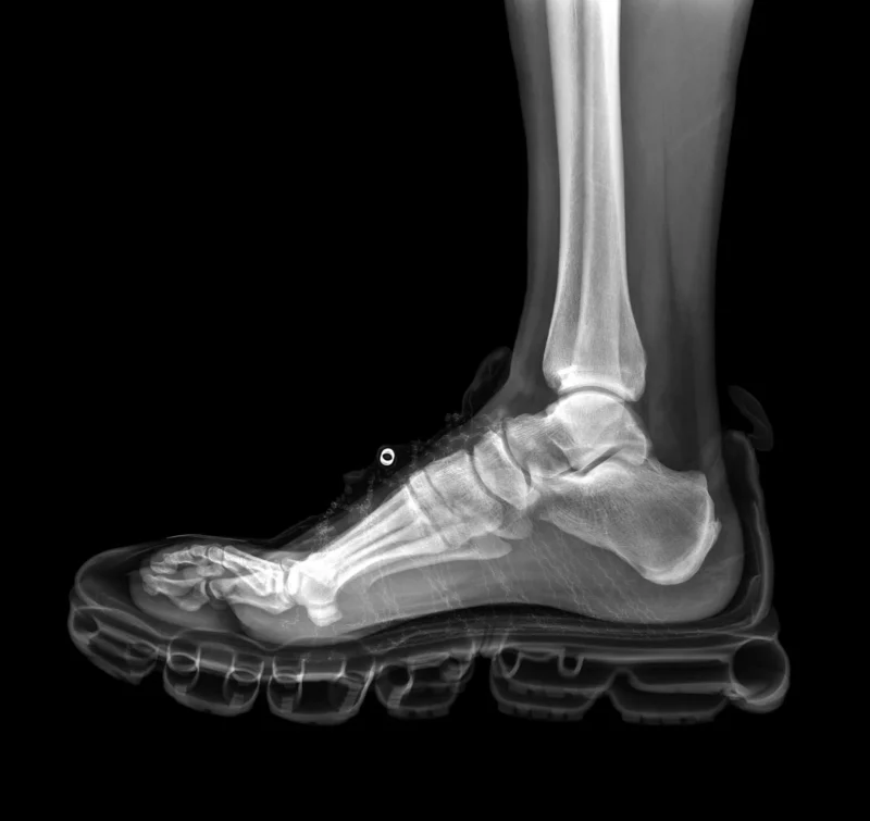 duman foot in sneaker