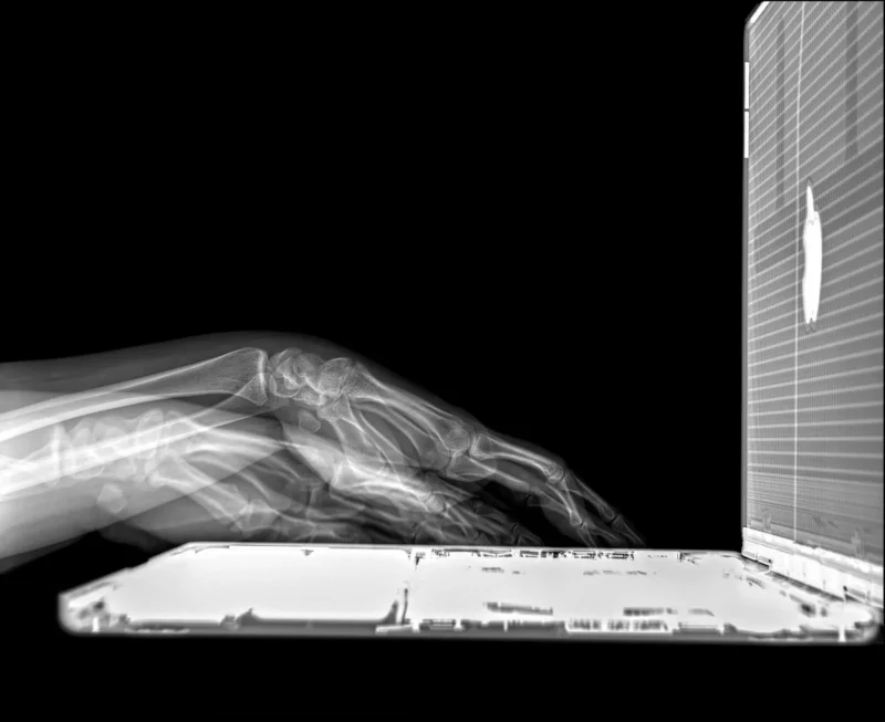 Andrei Duman: X-Ray 6 duman typing on macbook pro