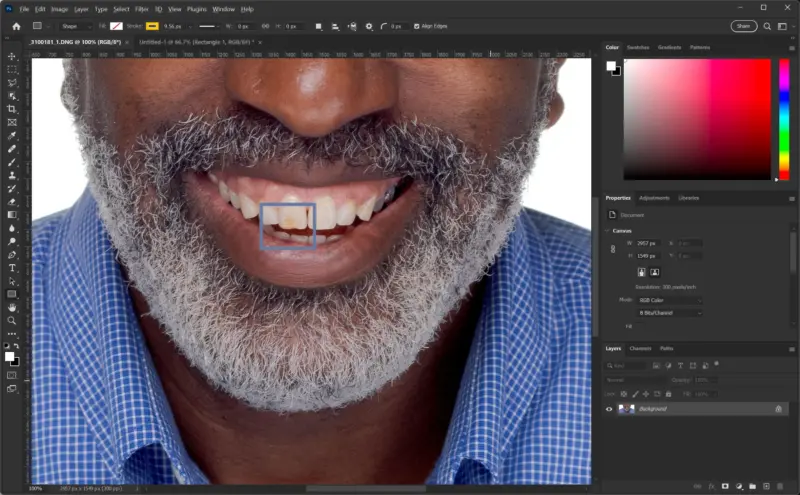 Photoshop'ta Dişler Nasıl Beyazlatılır 15 Figure13