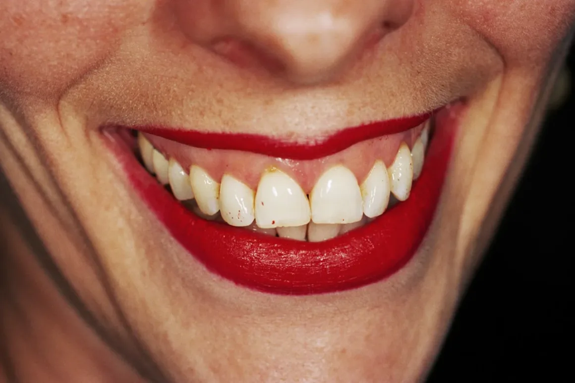 Martin Parr – Common Sense intense color close up