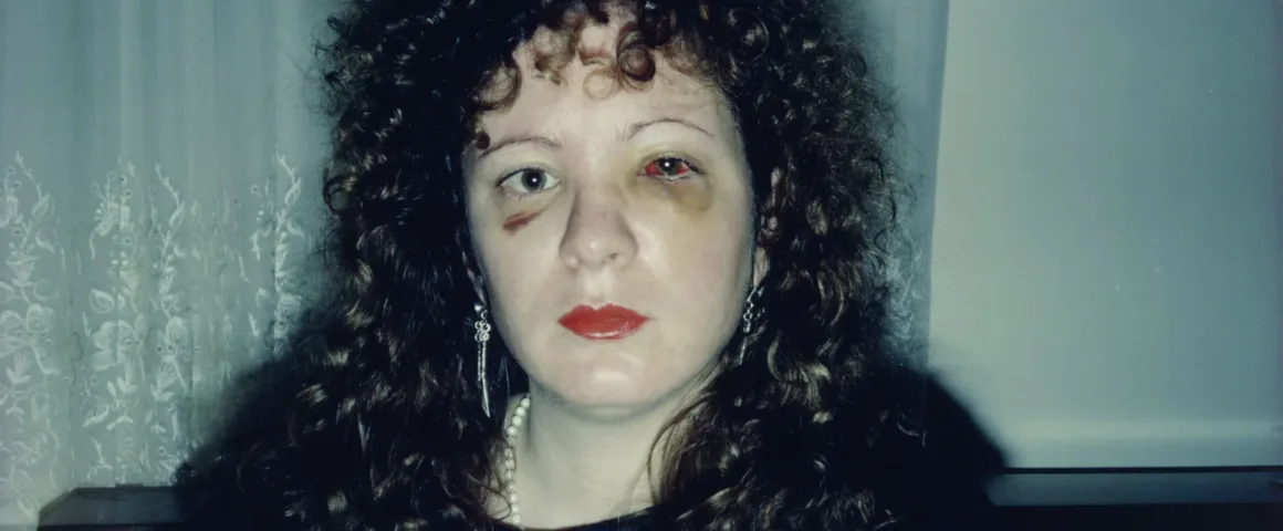 Nan Goldin: Mahremiyetin, Aşkın ve Kayıpların Fotoğrafçısı