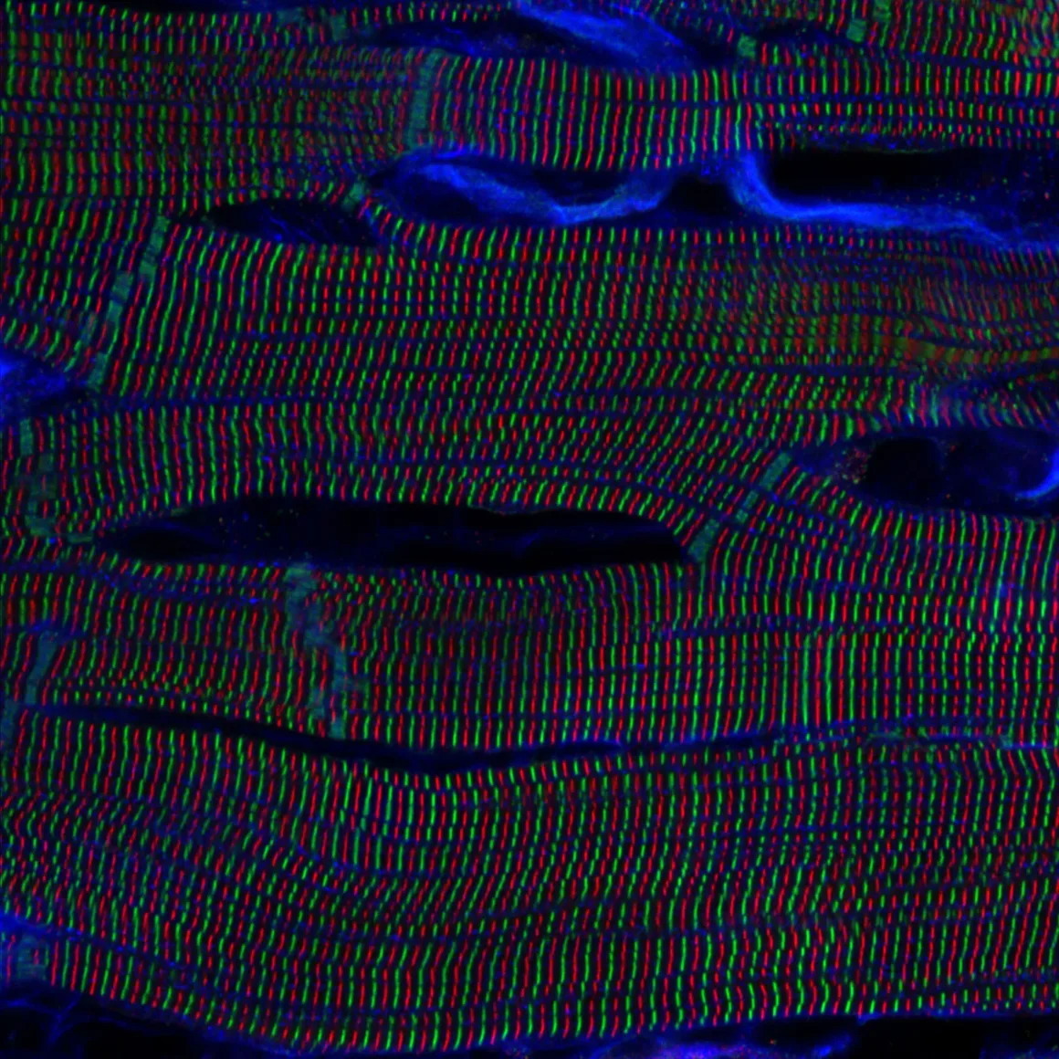 Kas dokusunda çizgili yapı gösteren renkli mikroskobik lifler