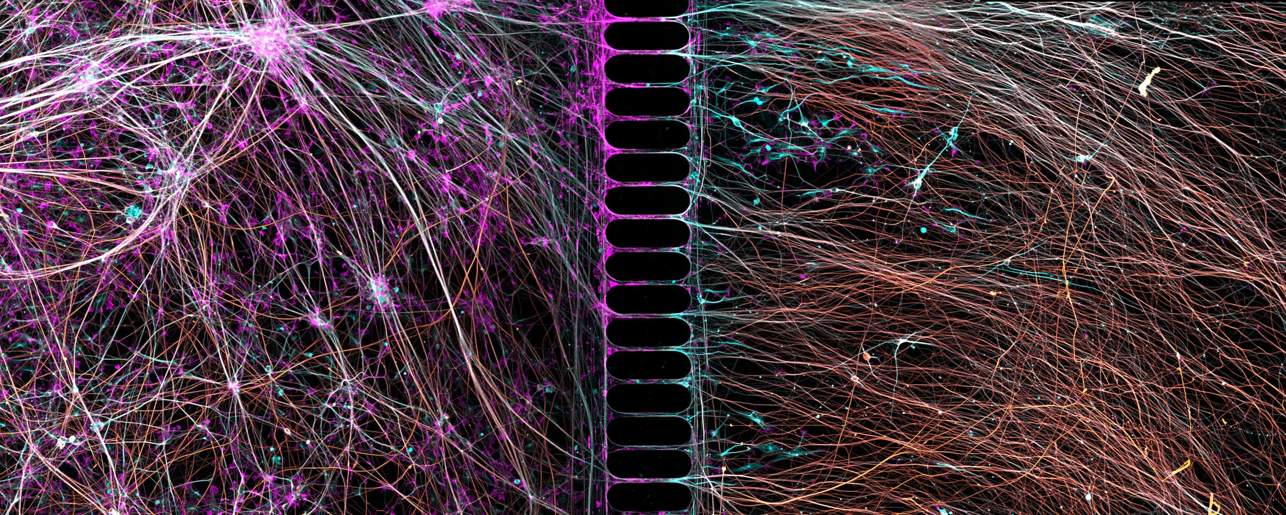 Nikon Small World 2026 Kazananları Açıklandı: Mikroskobik Dünyadan Büyüleyici Görüntüler 25 A fluorescence microscopy image shows two populations of neurons separated by a microfluidic device with thin axonal channels.