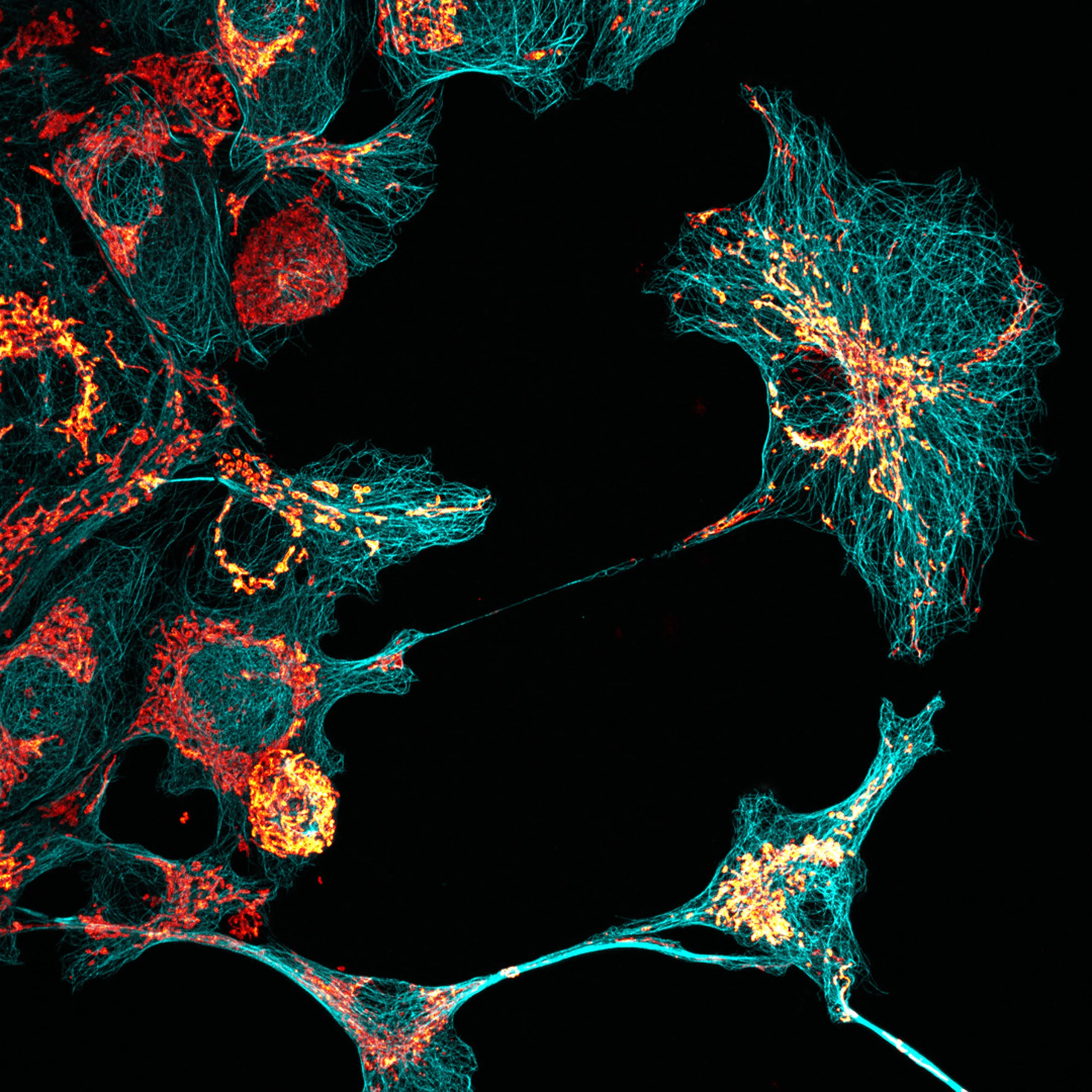 Nikon Small World 2026 Kazananları Açıklandı: Mikroskobik Dünyadan Büyüleyici Görüntüler 41 A fluorescence microscopy image shows cells with a cyan-colored network of filaments and bright orange-red organelles.