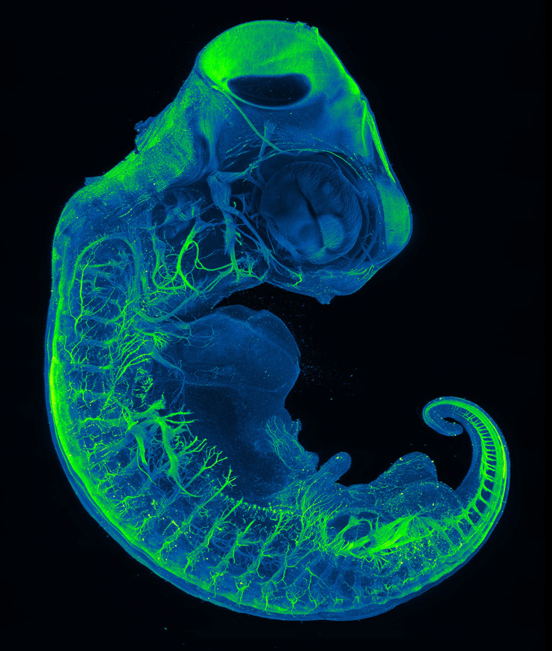Nikon Small World 2026 Kazananları Açıklandı: Mikroskobik Dünyadan Büyüleyici Görüntüler 44 A fluorescent microscopic view of a developing zebrafish embryo, highlighting its nervous system and vascular network in green.