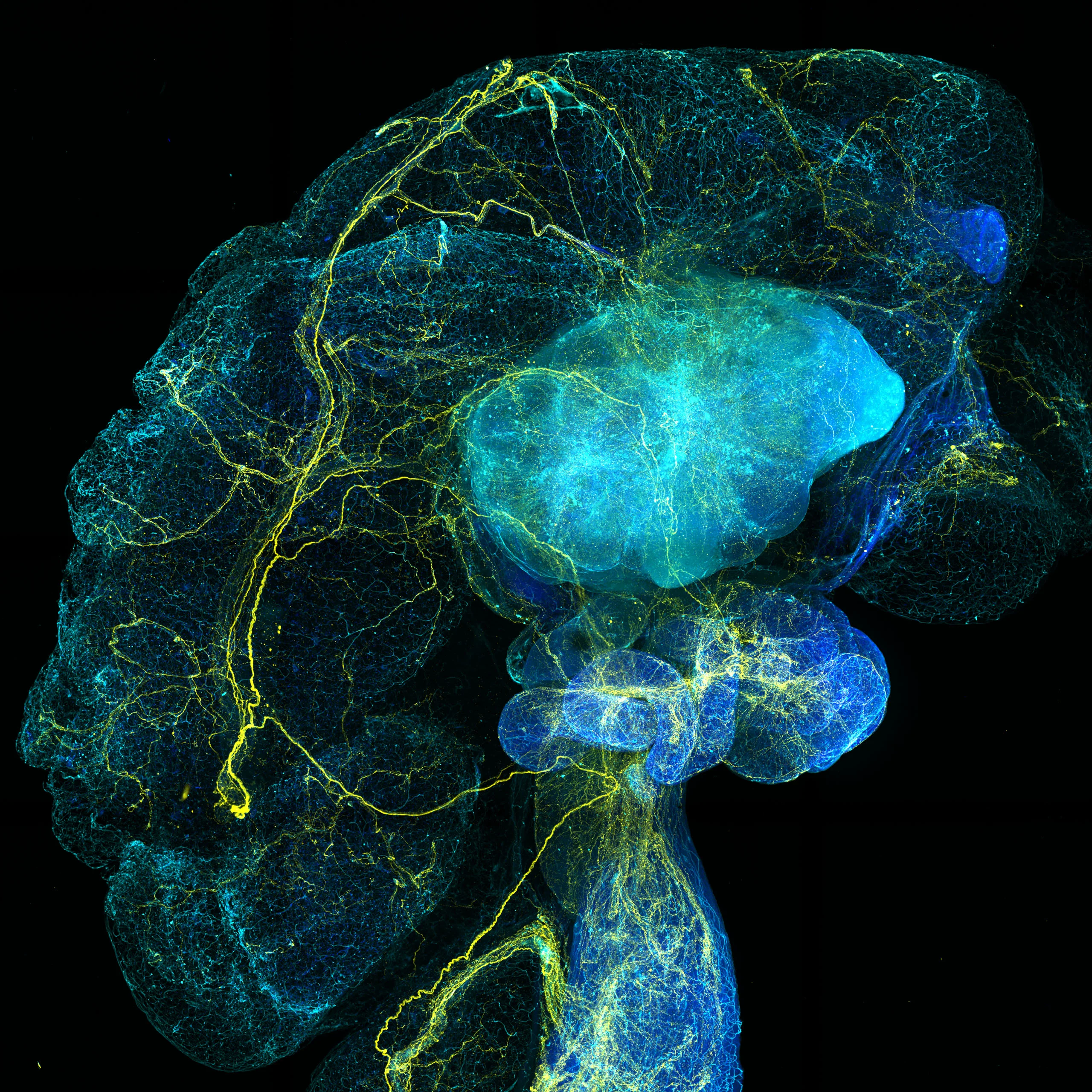 Nikon Small World 2026 Kazananları Açıklandı: Mikroskobik Dünyadan Büyüleyici Görüntüler 48 A fluorescent microscopic view of a mouse brain showing a dense network of blue neural tissue and yellow nerve fibers.