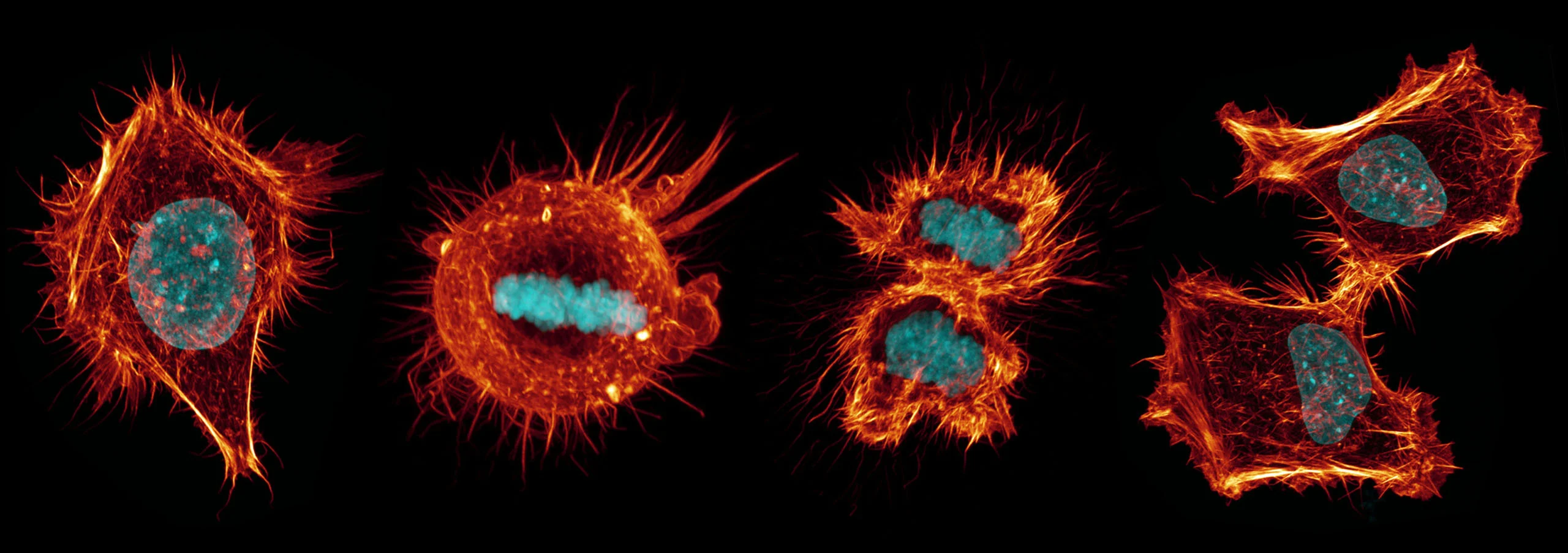 Nikon Small World 2026 Kazananları Açıklandı: Mikroskobik Dünyadan Büyüleyici Görüntüler 62 Four cells in various stages of division are shown against a black background, with glowing orange cytoskeletons and cyan nuclei.