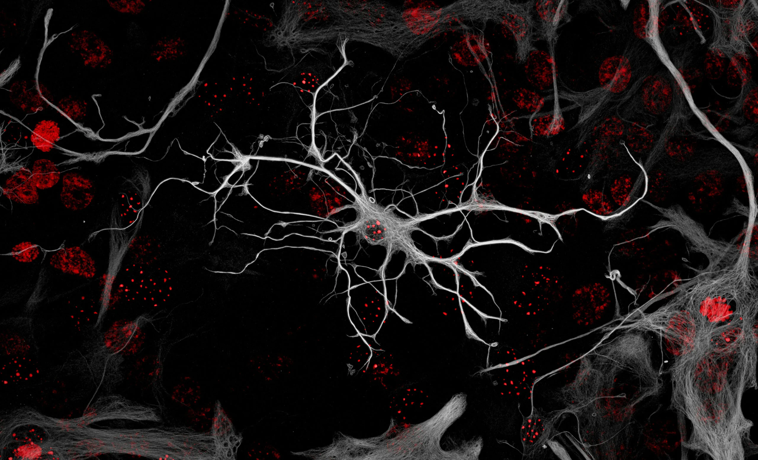 Nikon Small World 2026 Kazananları Açıklandı: Mikroskobik Dünyadan Büyüleyici Görüntüler 60 A fluorescence microscopy image shows a central, star-shaped neuron with long, branching white filaments surrounded by numerous red-stained cell nuclei against a black background.