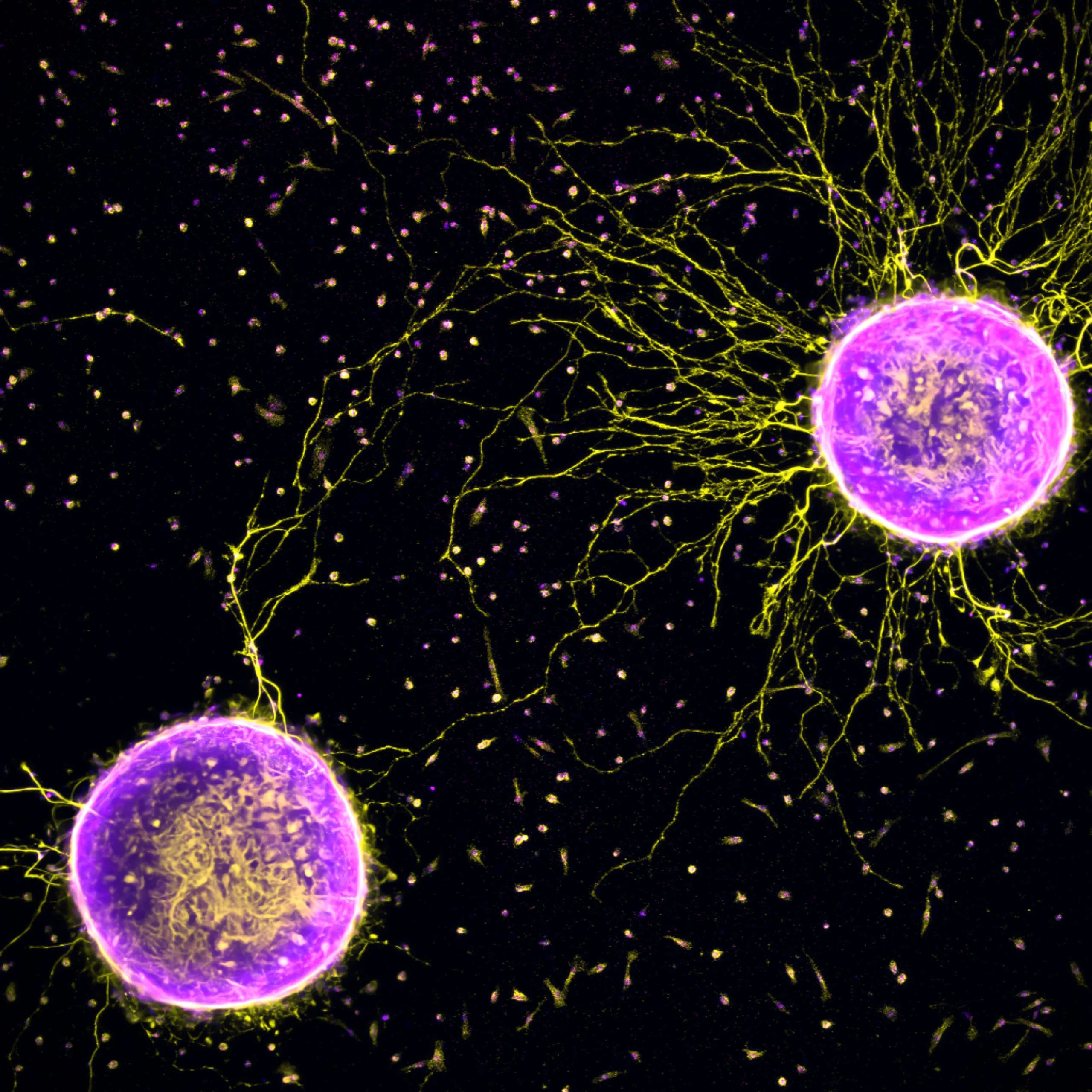 Nikon Small World 2026 Kazananları Açıklandı: Mikroskobik Dünyadan Büyüleyici Görüntüler 58 Two bright purple, spherical cell clusters are connected by a network of thin, yellow, branching filaments against a black background.