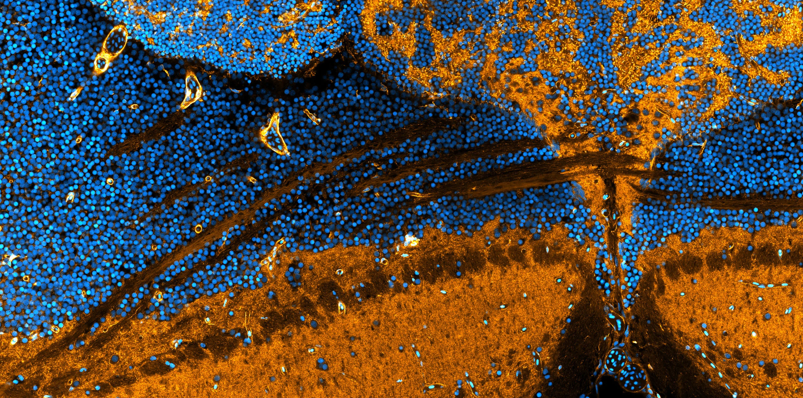 Nikon Small World 2026 Kazananları Açıklandı: Mikroskobik Dünyadan Büyüleyici Görüntüler 54 A microscopic view of brain tissue showing dense clusters of blue-stained cell nuclei contrasted against orange-stained neural fibers.