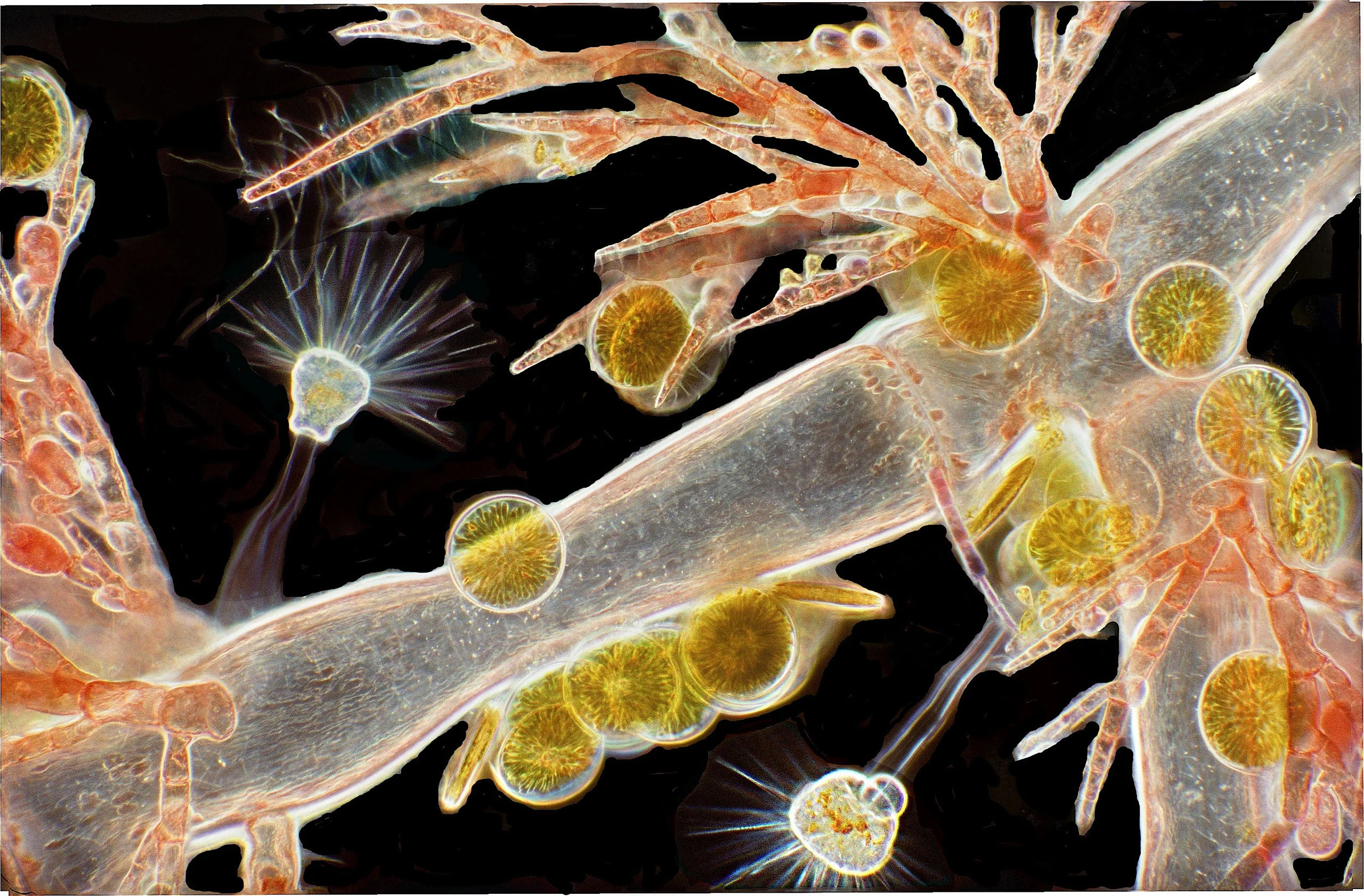 Nikon Small World 2026 Kazananları Açıklandı: Mikroskobik Dünyadan Büyüleyici Görüntüler 52 A microscopic view shows orange, branching filamentous algae hosting several circular, golden-brown diatoms and two stalked, fan-shaped protozoa.