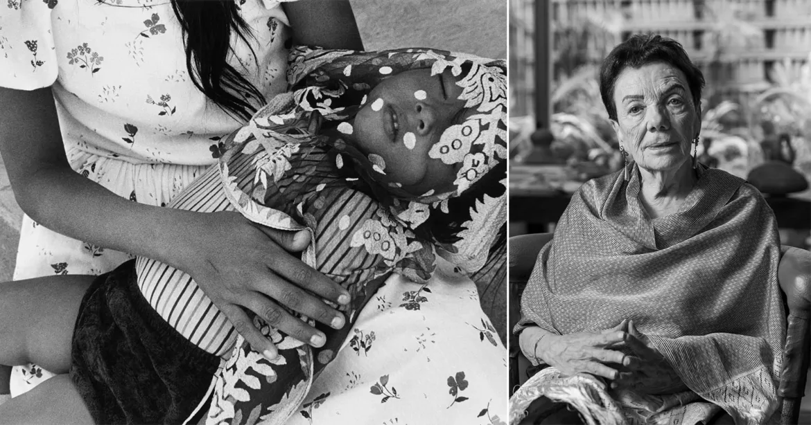 A split-screen image showing a person holding a child with white spots on their face on the left, and an older woman sitting with her hands clasped on the right.